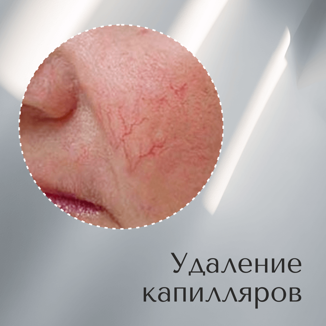 LaserFest_uudiskiri3ru
