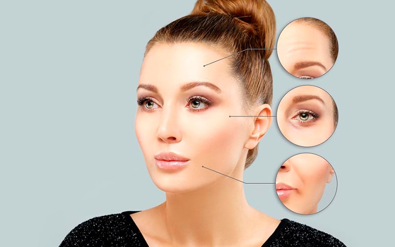 volite800x500-min biorevitalisatsioon volite tallinnas